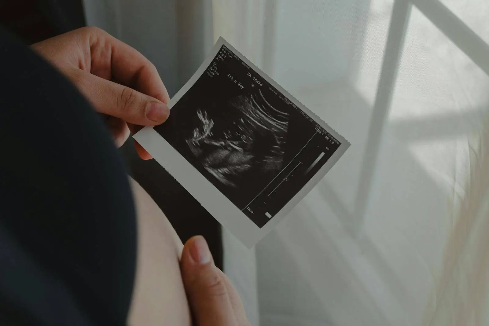 Intended parent holding ultrasound image during international surrogacy journey with California agency EDSI