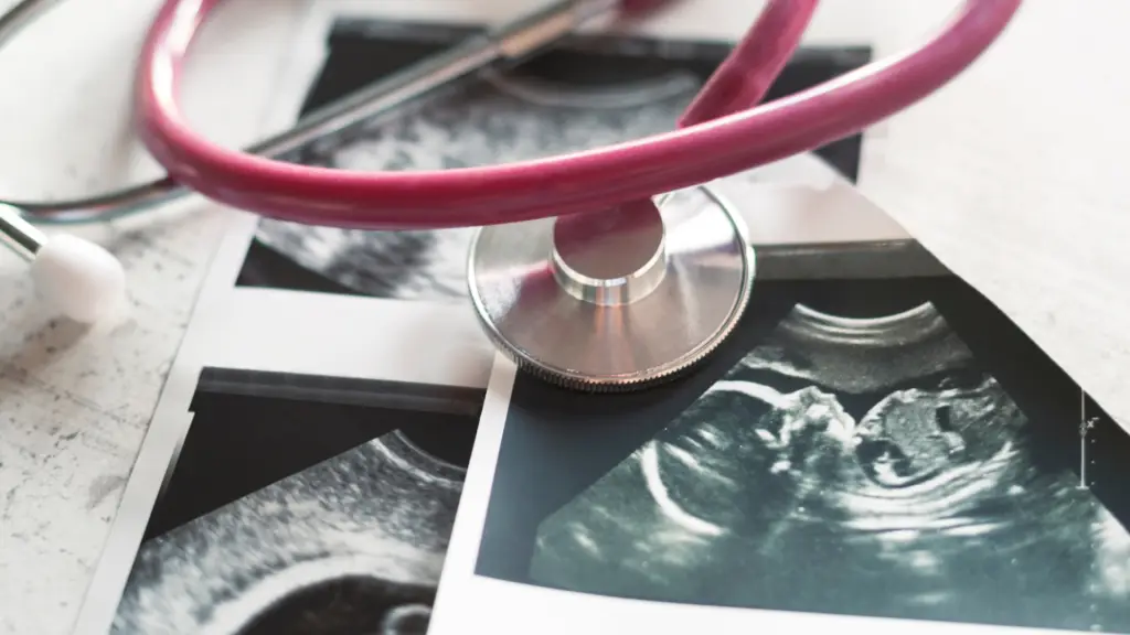 Close-up of a stethoscope resting on ultrasound scans, representing advancements in IVF and gestational surrogacy care in 2025.