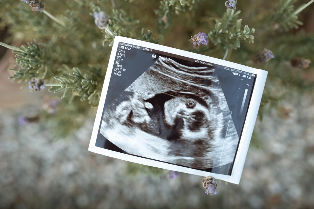 Ultrasound image representing pregnancy through gestational surrogacy with existing embryos
